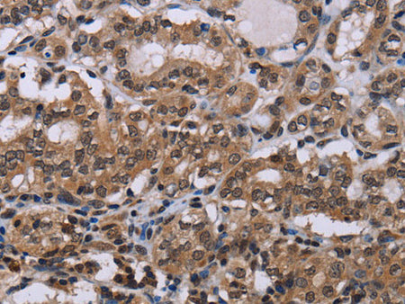 DLX4 Polyclonal Antibody Store at -20°C