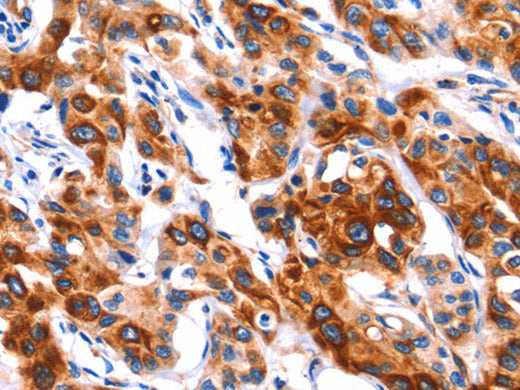 SEPT4 Polyclonal Antibody Store at -20°C