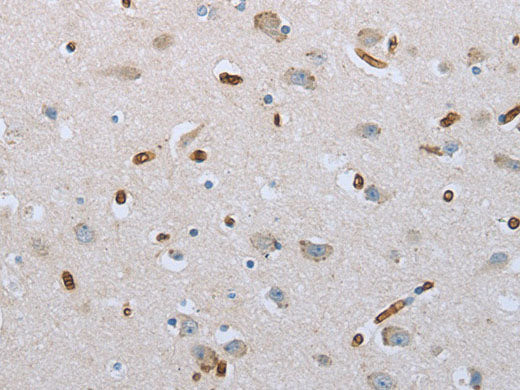 FGF1 Polyclonal Antibody Store at -20°C
