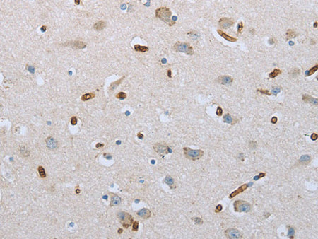 FGF1 Polyclonal Antibody Store at -20°C