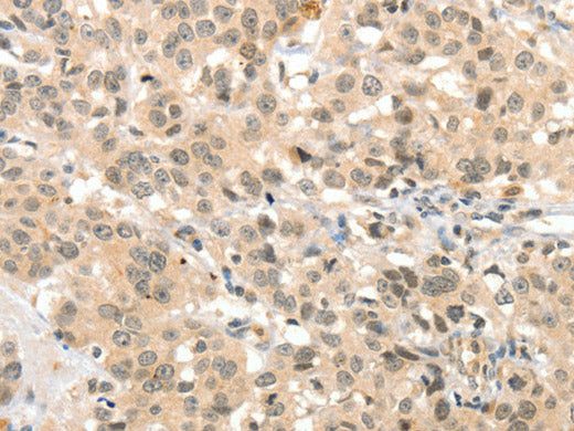 TSPYL2 Polyclonal Antibody Store at -20°C