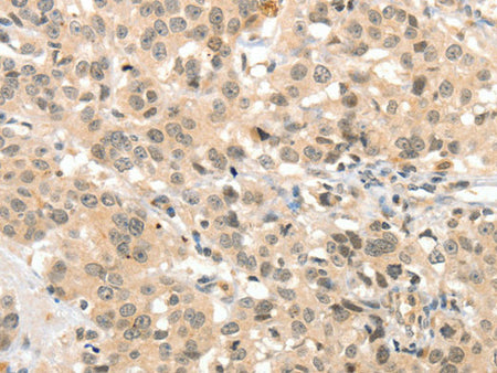 TSPYL2 Polyclonal Antibody Store at -20°C