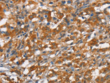 CD168 Polyclonal Antibody