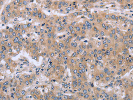 ECE1 Polyclonal Antibody Store at -20°C