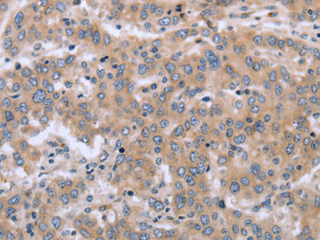 ECE1 Polyclonal Antibody Store at -20°C