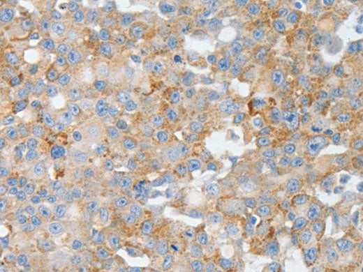 BPIFB2 Polyclonal Antibody Store at -20°C