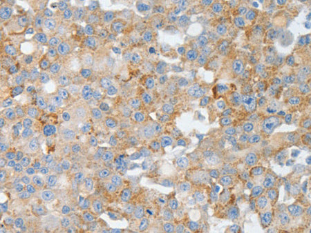 BPIFB2 Polyclonal Antibody Store at -20°C