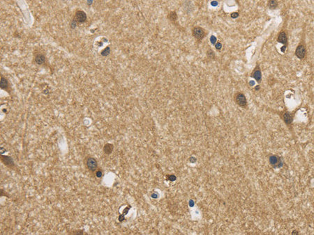 GAS7 Polyclonal Antibody Store at -20°C
