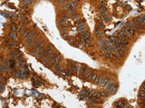 IL20RA Polyclonal Antibody Store at -20°C