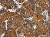 CATSPER3 Polyclonal Antibody