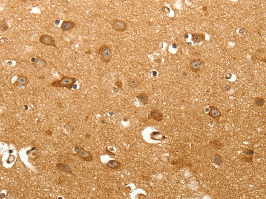 MAP1B Polyclonal Antibody Store at -20°C