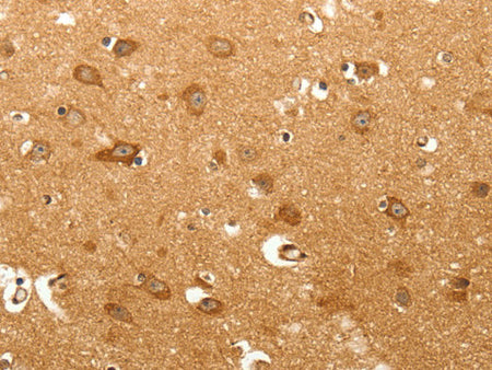MAP1B Polyclonal Antibody Store at -20°C