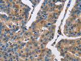 CBR1 Polyclonal Antibody Store at -20°C
