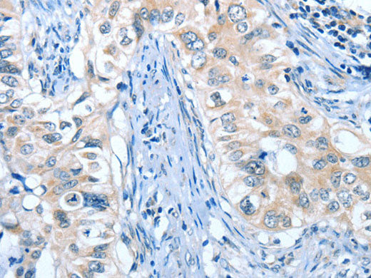 ANGPT2 Polyclonal Antibody Store at -20°C