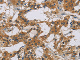IL18R1 Polyclonal Antibody Store at -20°C