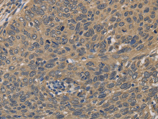 HSF1 Polyclonal Antibody Store at -20°C