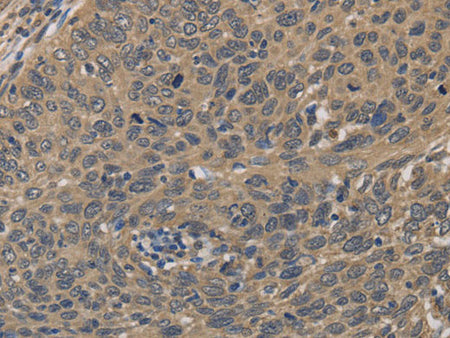 HSF1 Polyclonal Antibody Store at -20°C