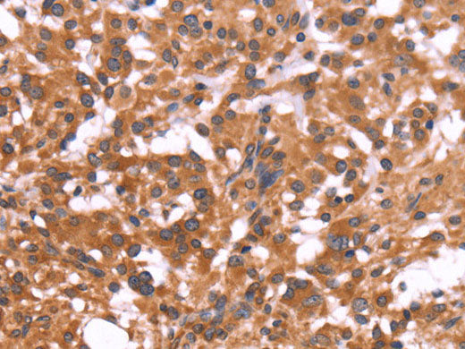 CRISP3 Polyclonal Antibody Store at -20°C - MSE Supplies LLC