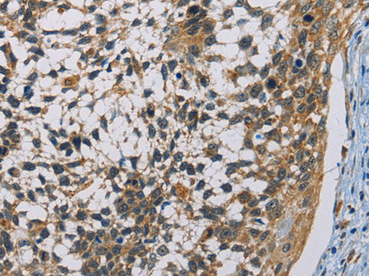 CSNK1E Polyclonal Antibody Store at -20°C