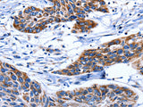 AQP8 Polyclonal Antibody