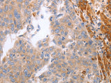 NRTN Polyclonal Antibody