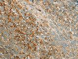 AMPK alpha1 Polyclonal Antibody