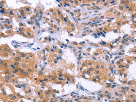 ESPL1 Polyclonal Antibody Store at -20°C