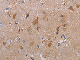 MAGEF1 Polyclonal Antibody