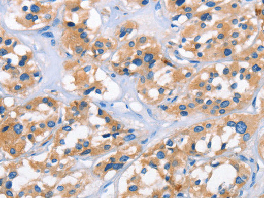 APOL6 Polyclonal Antibody Store at -20°C