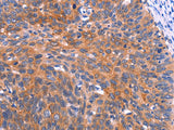 PTPN13 Polyclonal Antibody