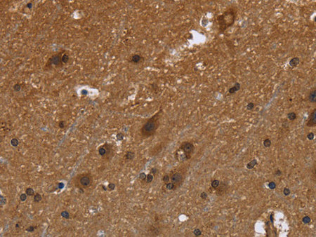 FRK Polyclonal Antibody Store at -20°C
