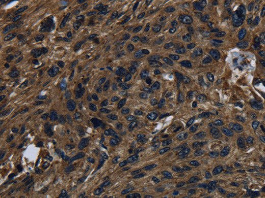KLK14 Polyclonal Antibody Store at -20°C