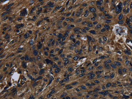 KLK14 Polyclonal Antibody Store at -20°C