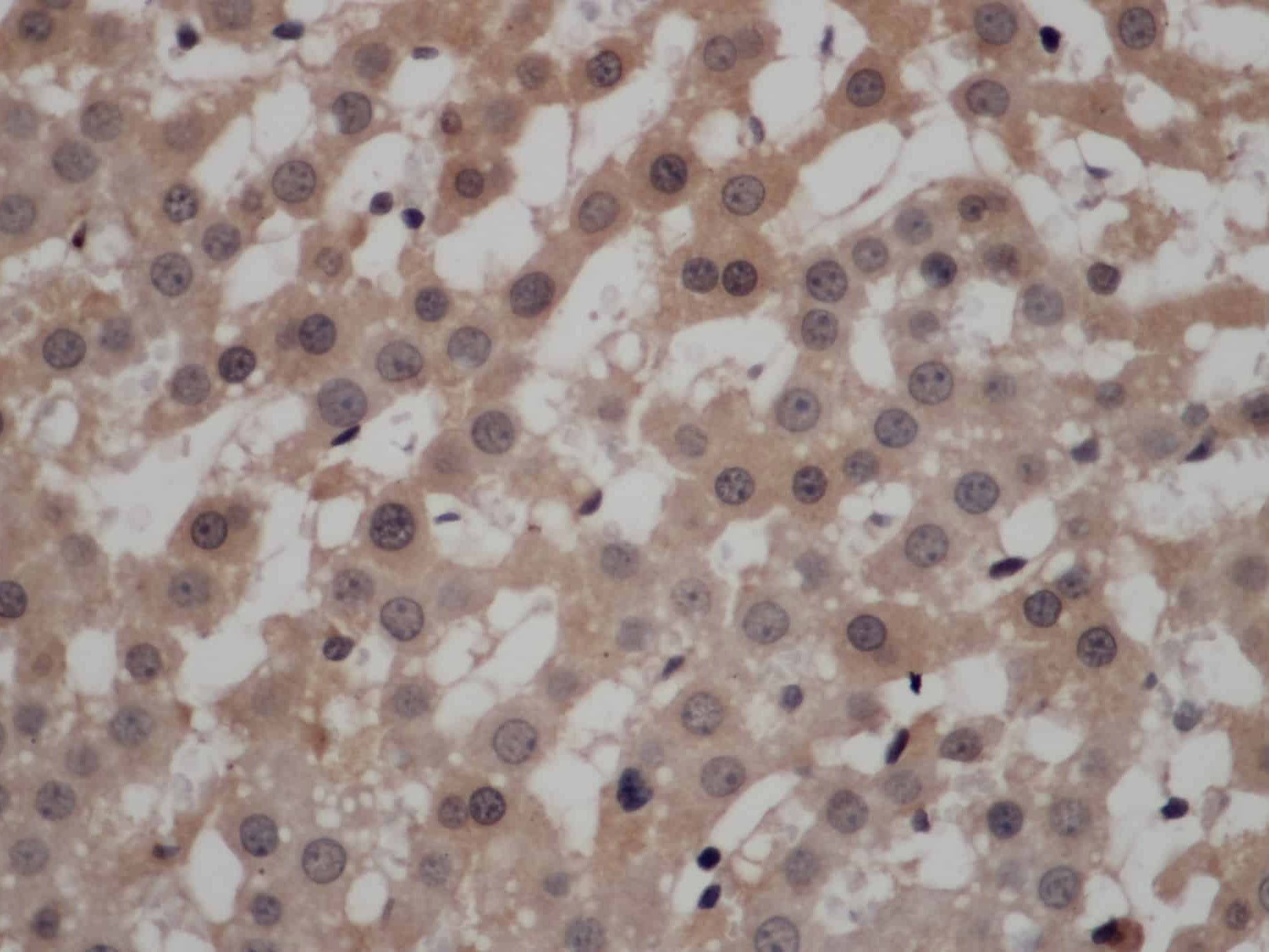 CALCRL Polyclonal Antibody Store at -20°C