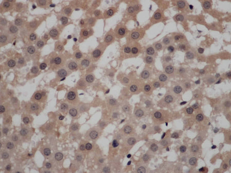 CALCRL Polyclonal Antibody Store at -20°C