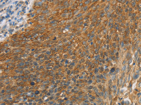 ERK 3 Polyclonal Antibody Store at -20°C