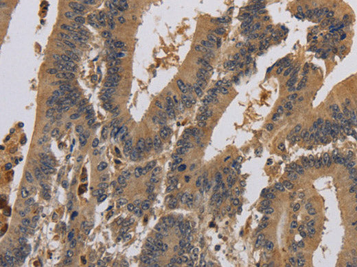 KCNA7 Polyclonal Antibody Store at -20°C
