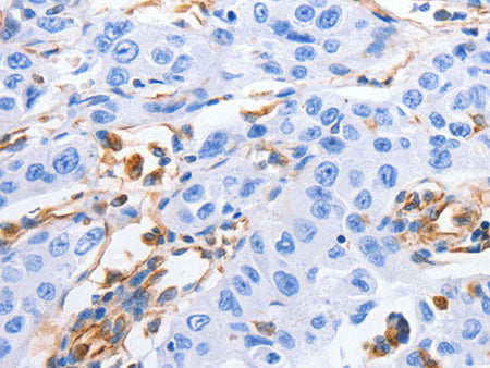 MFN1 Polyclonal Antibody Store at -20°C