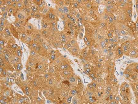 NGF Polyclonal Antibody Store at -20°C