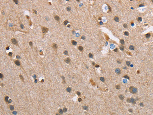SERPINA1 Polyclonal Antibody Store at -20°C