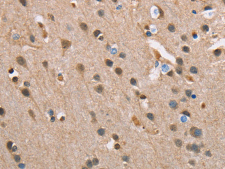 SERPINA1 Polyclonal Antibody Store at -20°C