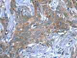 SCPEP1 Polyclonal Antibody