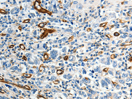 ABCG1 Polyclonal Antibody Store at -20°C