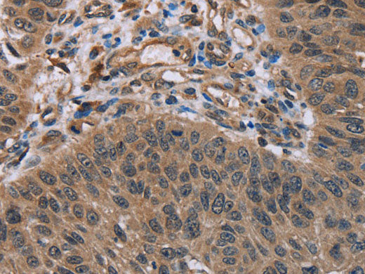 HOMER1 Polyclonal Antibody Store at -20°C