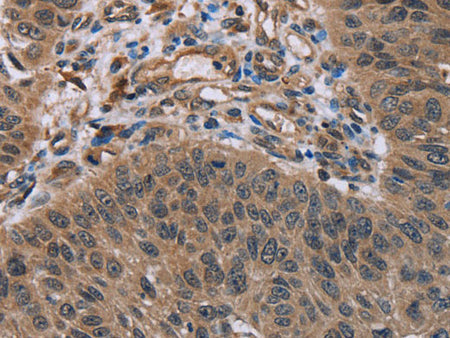 HOMER1 Polyclonal Antibody Store at -20°C