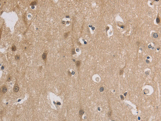 ELOVL1 Polyclonal Antibody