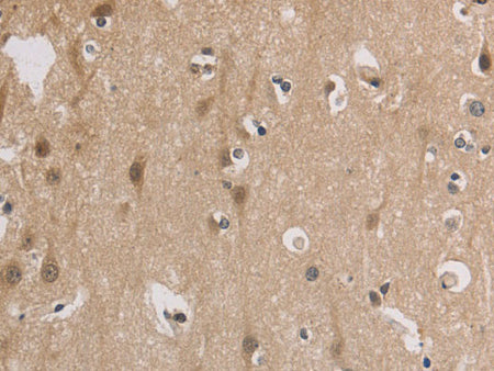 ELOVL1 Polyclonal Antibody