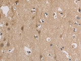 ELOVL1 Polyclonal Antibody