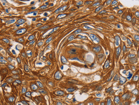 GRIN1 Polyclonal Antibody Store at -20°C