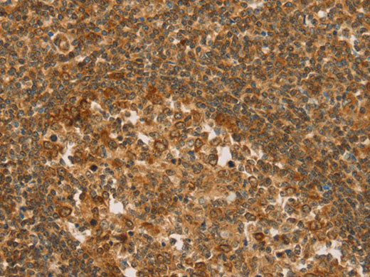 SLC6A3 Polyclonal Antibody Store at -20°C